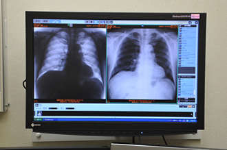 レントゲン写真・心電図・超音波検査結果なども画面で確認できます。